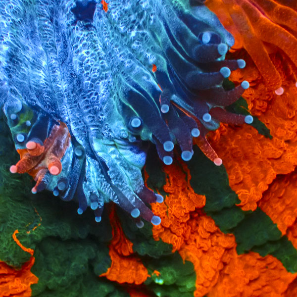 Acanthophyllia MC Sunken Crown